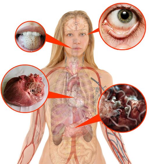 Parasites and worms in the human body